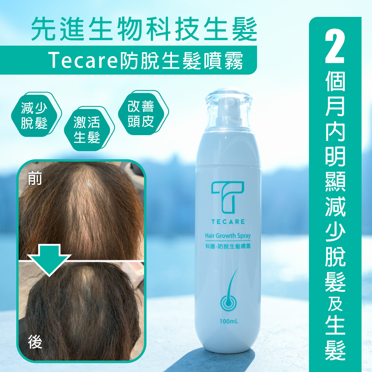 TECARE 防脫生髮噴霧 - 生物技術養髮 (男女適用/產後脫髮適用) (100ml)